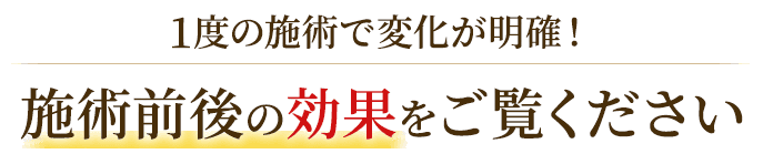 施術前後の効果をご覧ください