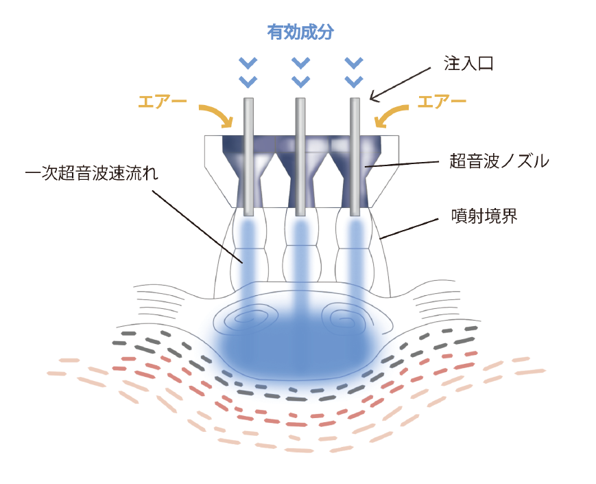 ニードルレスインジェクターとは