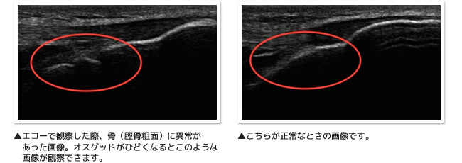 エコー比較写真